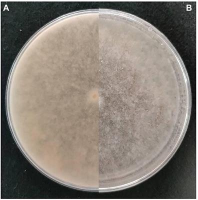 Phenotypic analysis and genome sequence of Rhizopus oryzae strain Y5, the causal agent of tobacco pole rot